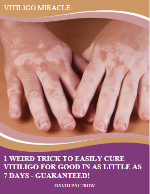 Vitiligo Miracle PDF, eBook by David Paltrow