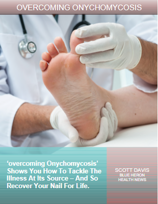 Overcoming Onychomycosis PDF